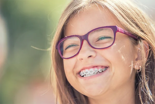Orthodontic or Braces Treatment